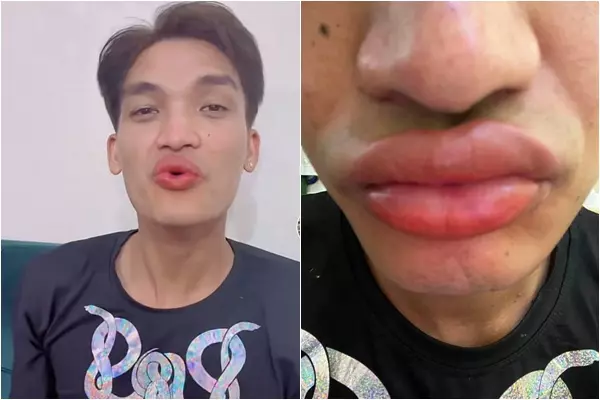 Mạc Văn Khoa cùng bờ môi tều mới làm xong